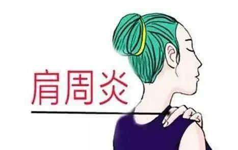 肩周炎治疗视频,跟随专业视频学习有效康复方法