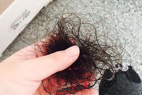 掉头发视频,视频解析脱发原因及防治方法