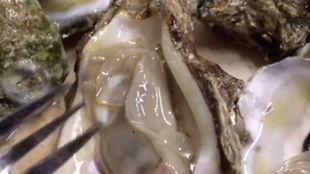 寄生虫视频大全,揭秘各类寄生虫的生存奥秘