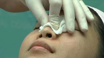 打针方法视频,轻松掌握打针技巧视频教程