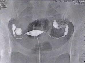 造影怎么做视频全过程,造影视频制作全过程解析