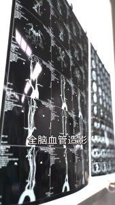 造影怎么做视频全过程,造影视频制作全过程解析