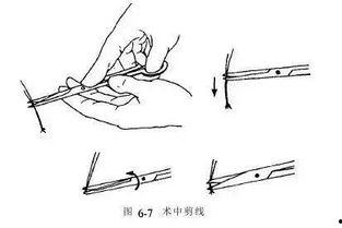 外科打结视频,视频教学带你轻松掌握手术缝合技艺