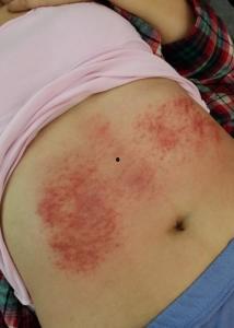 腹部刮痧视频,轻松养生，焕发健康活力