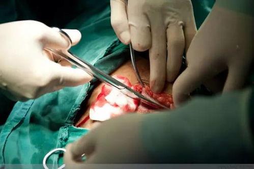 生小孩剖腹产视频,真实记录新生儿的诞生瞬间