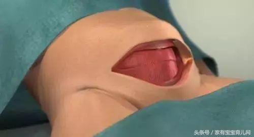 生小孩剖腹产视频,真实记录新生儿的诞生瞬间